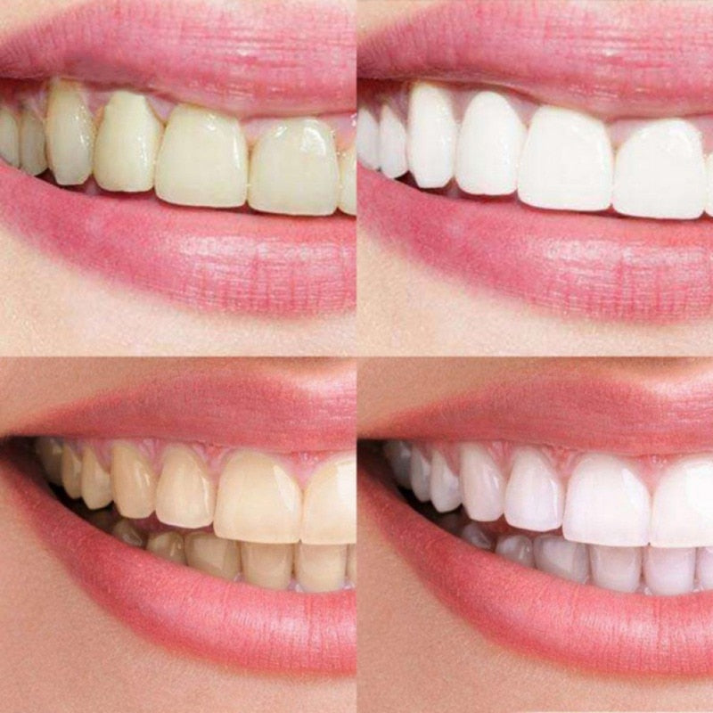 14 PCS Tooth Whitening Fast-Result  Non-Sensitive White Strips Teeth Whitening Strips  Teeth Whitening Kit