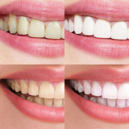 14 PCS Tooth Whitening Fast-Result  Non-Sensitive White Strips Teeth Whitening Strips  Teeth Whitening Kit